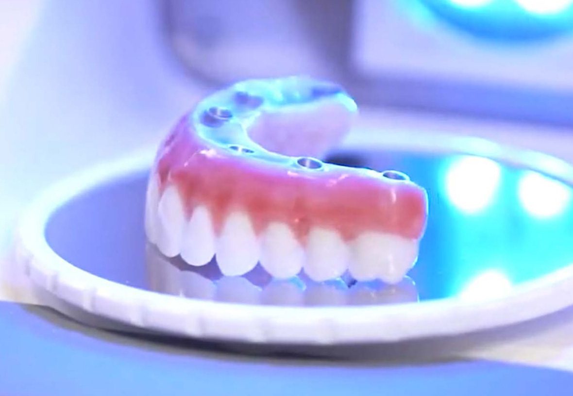 Denture Scan